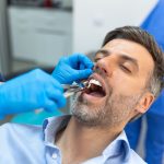 surgical tooth extraction