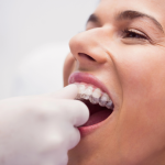 invisalign clear aligners for straighter teeth